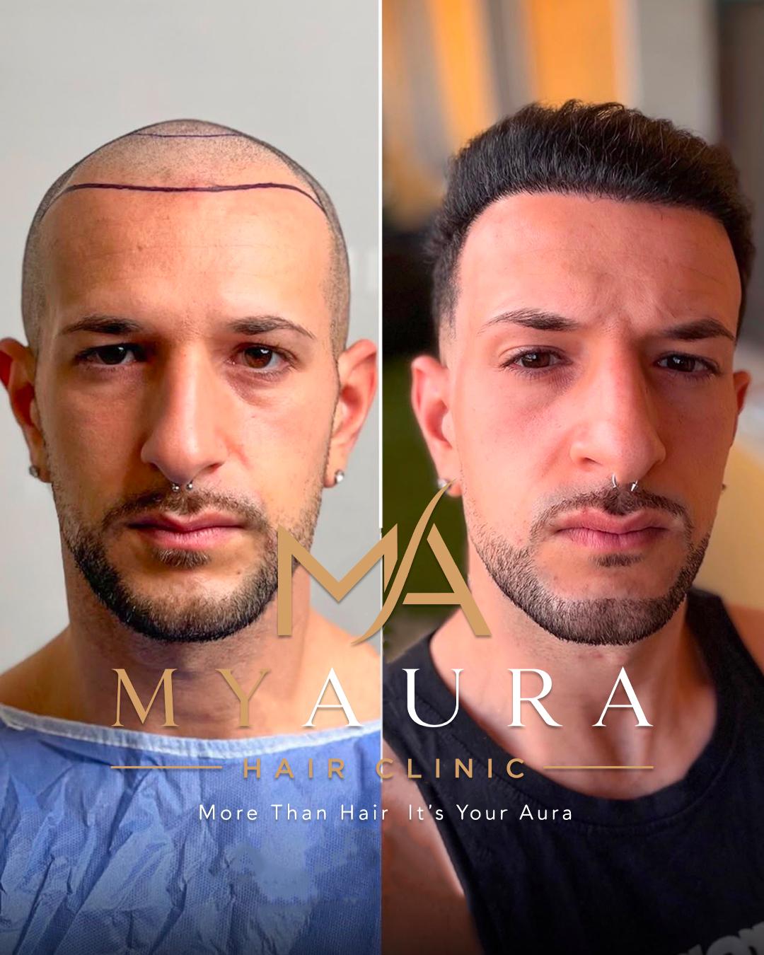 Avant / Après