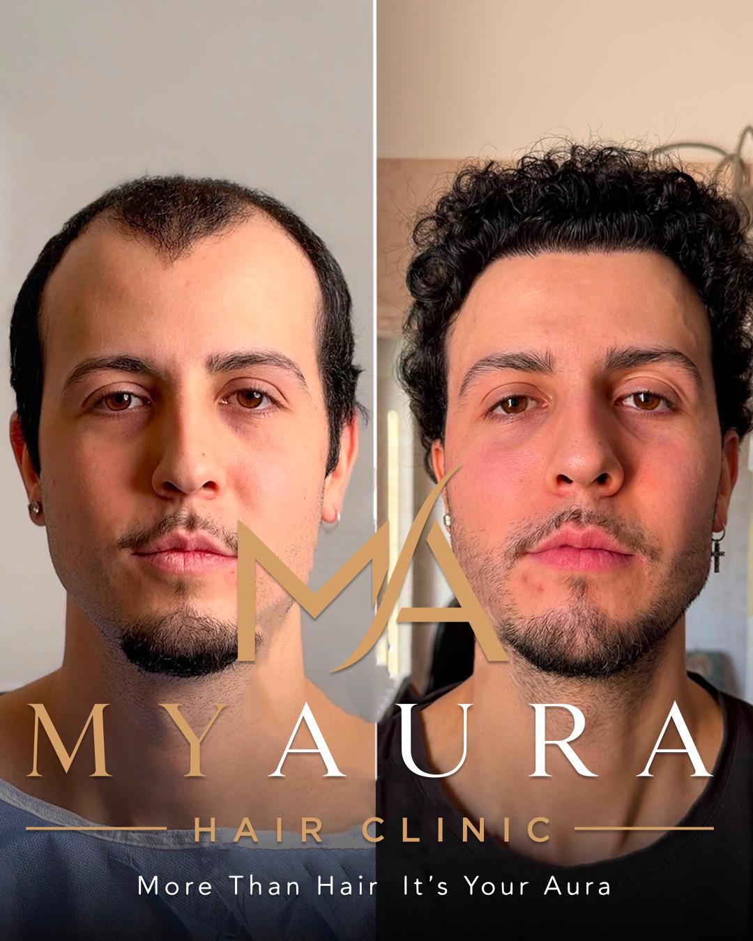 Avant / Après