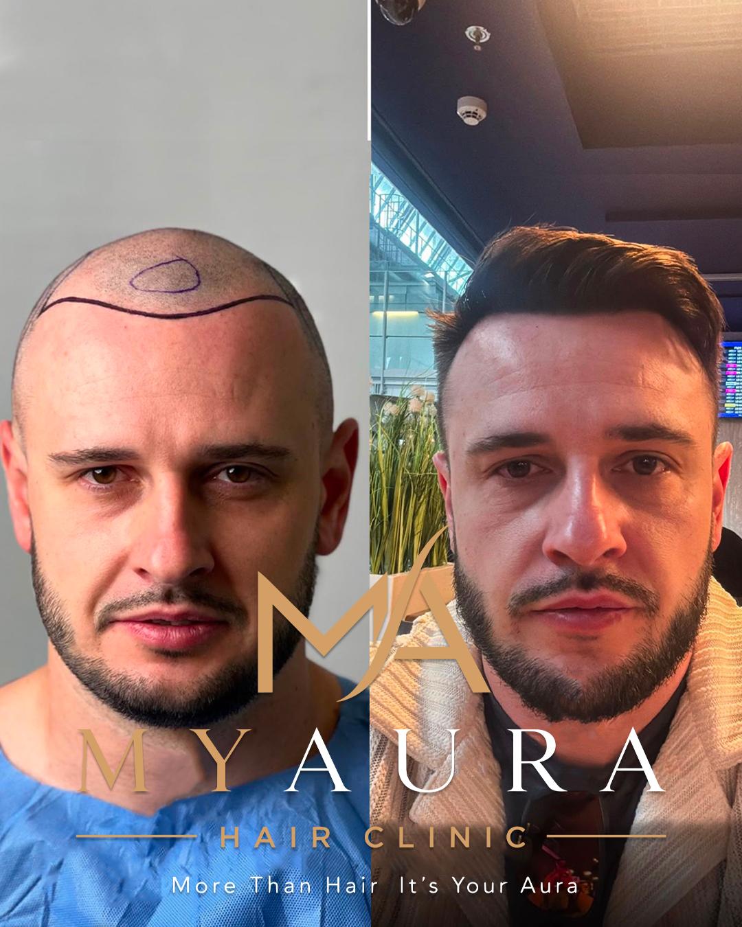 Avant / Après