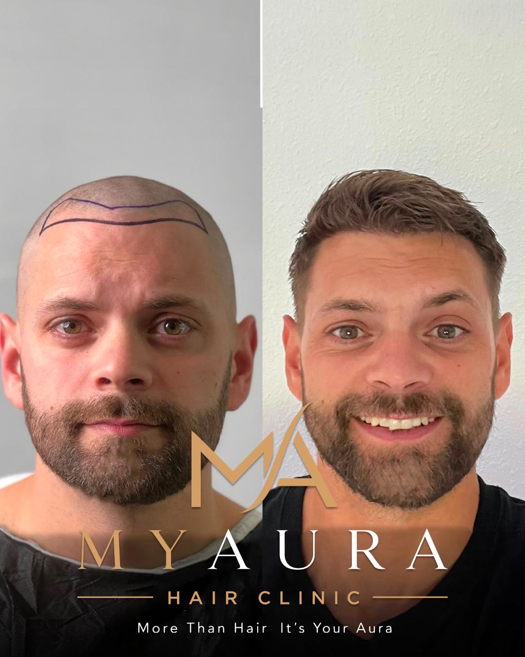 Avant / Après