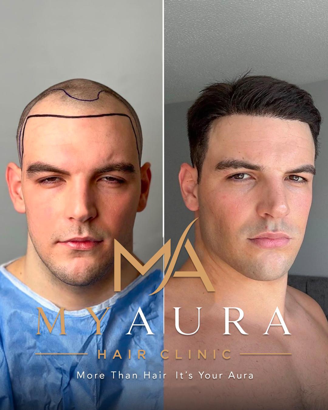 Avant / Après