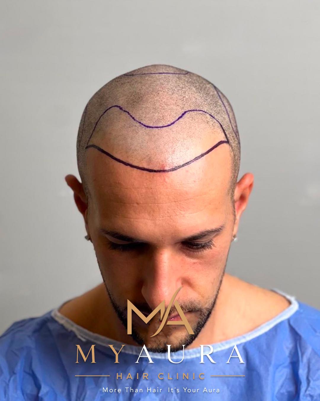Patient 1