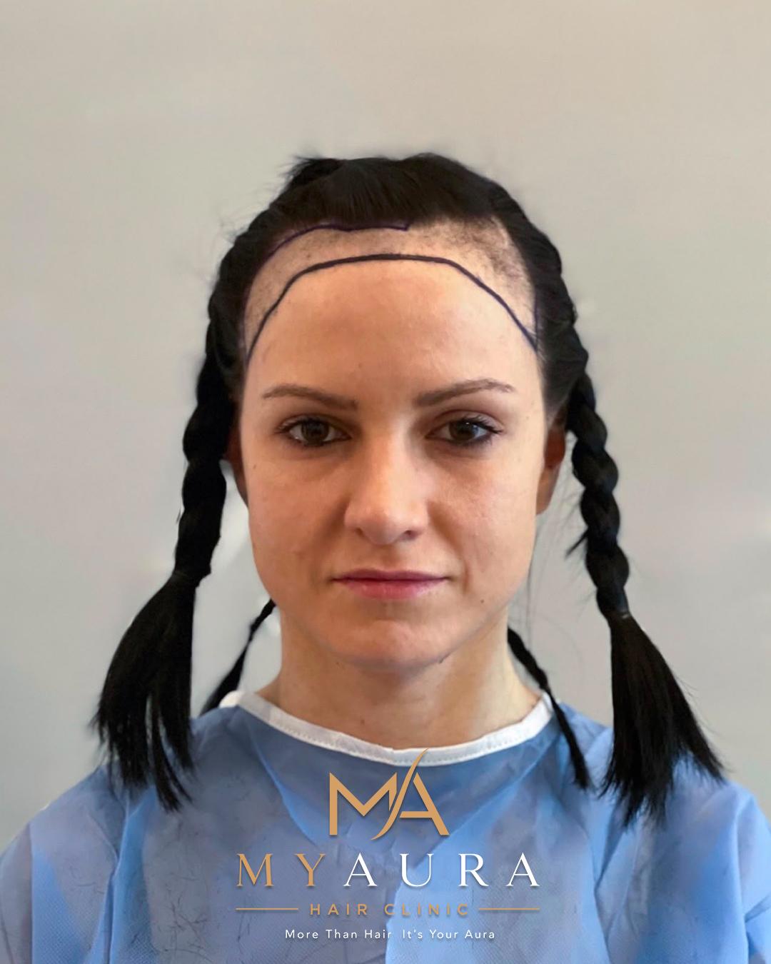 Patient 10